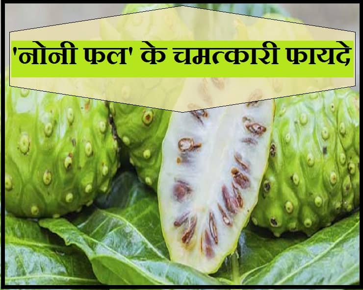 लेख की तस्वीर