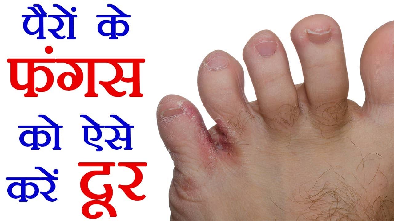 लेख की तस्वीर