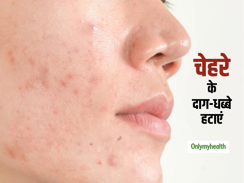लेख की तस्वीर