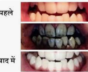लेख की तस्वीर