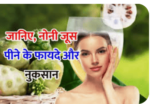 लेख की तस्वीर