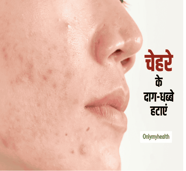 लेख की तस्वीर