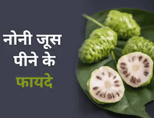 लेख की तस्वीर
