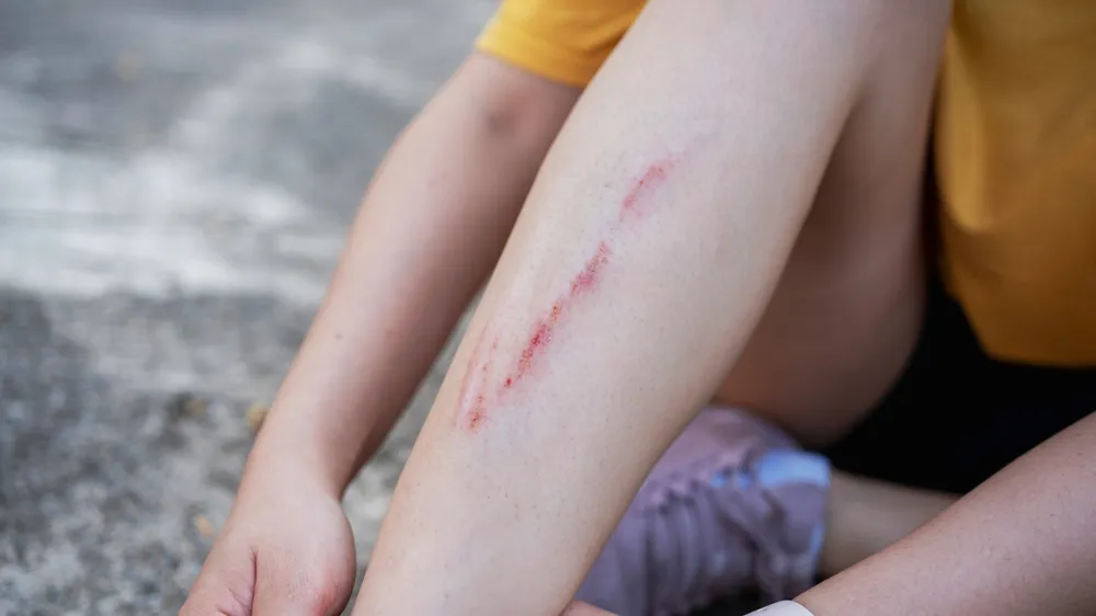 When a Pedestrian Injury Claim Involves More Than One Negligent Party